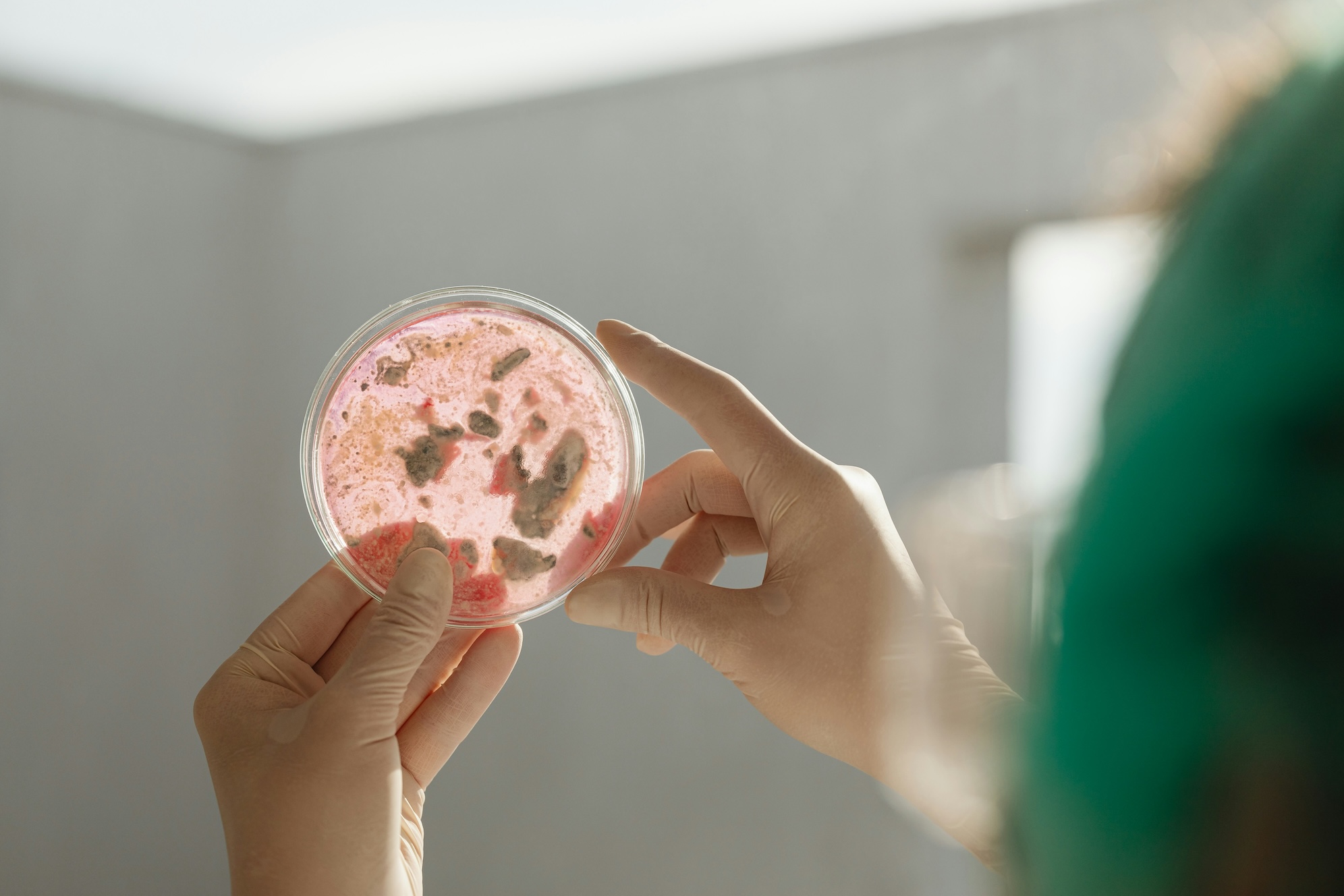 Gloved hand holding a petri dish with a mold sample